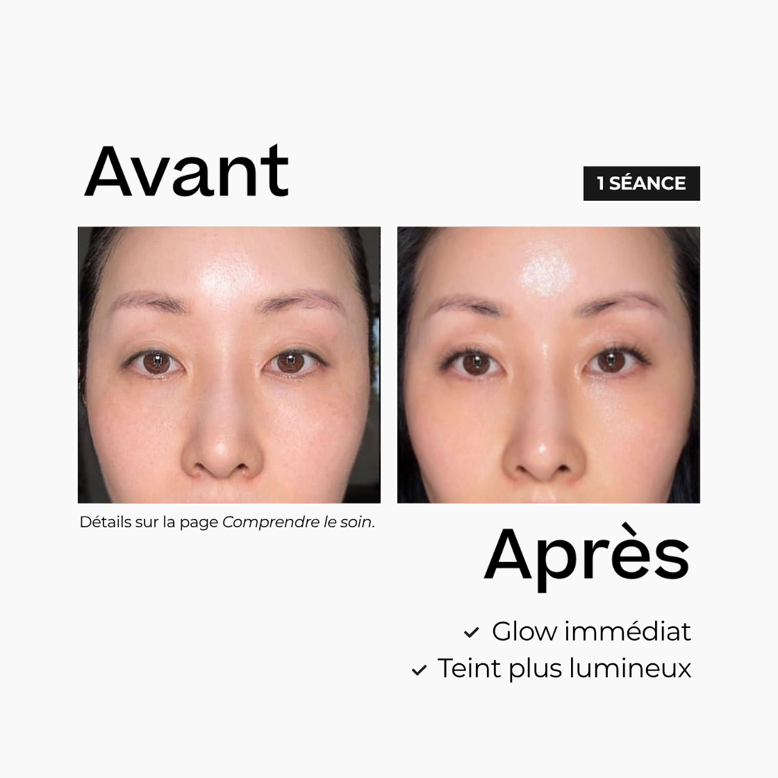 Le soin lumi